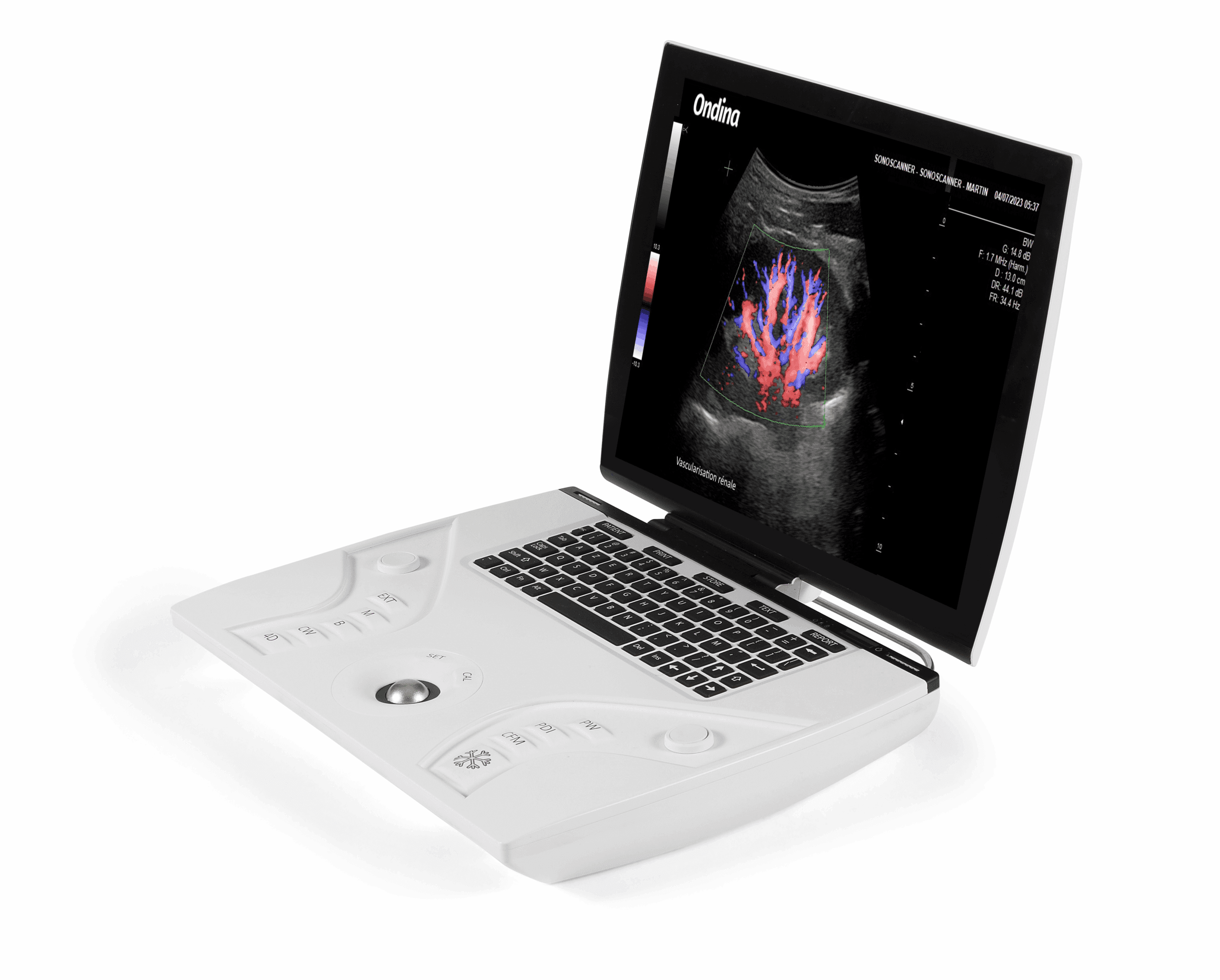 Echographe Portable Ondina AI Ready
