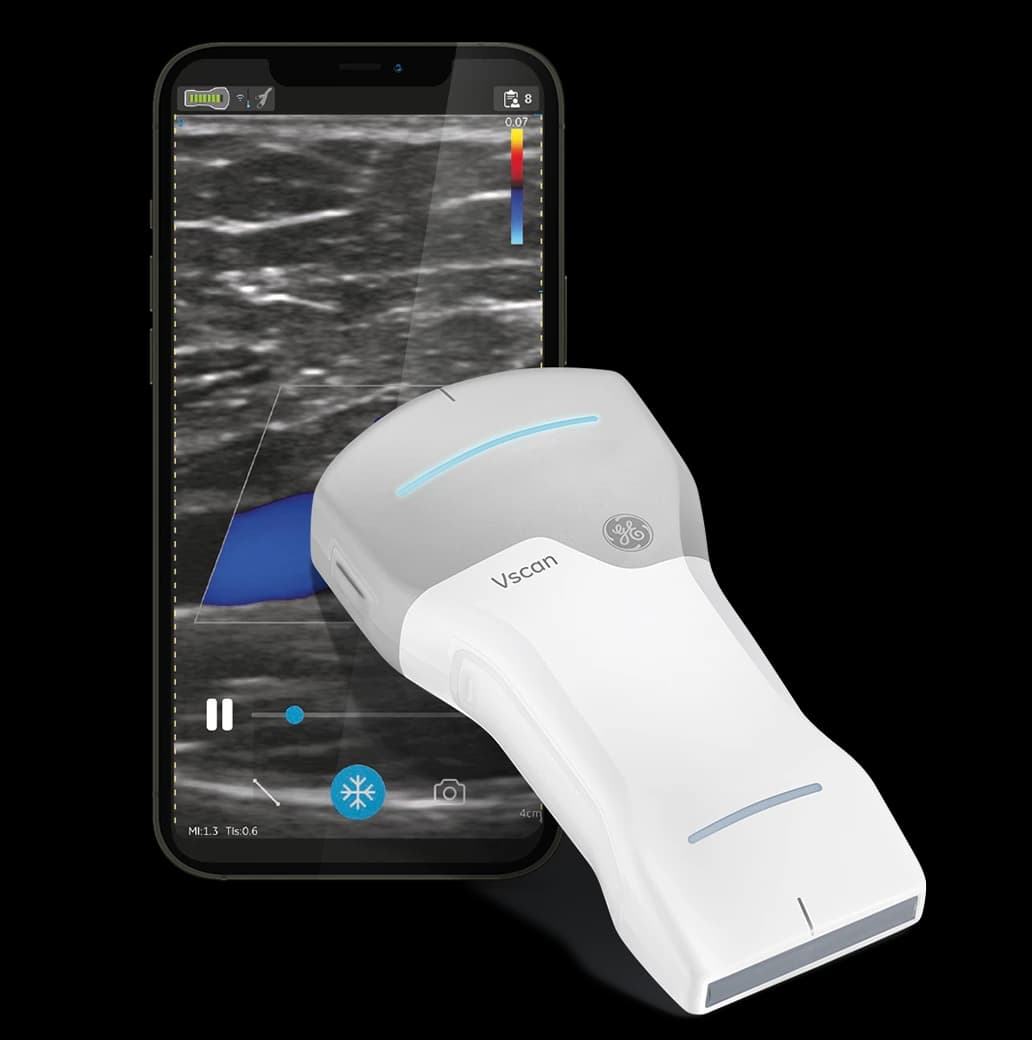 Échographe portable Vscan Air™