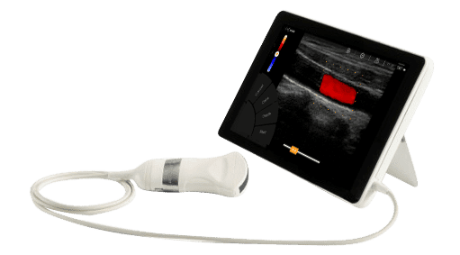 Sonoscanner T-Lite Pro