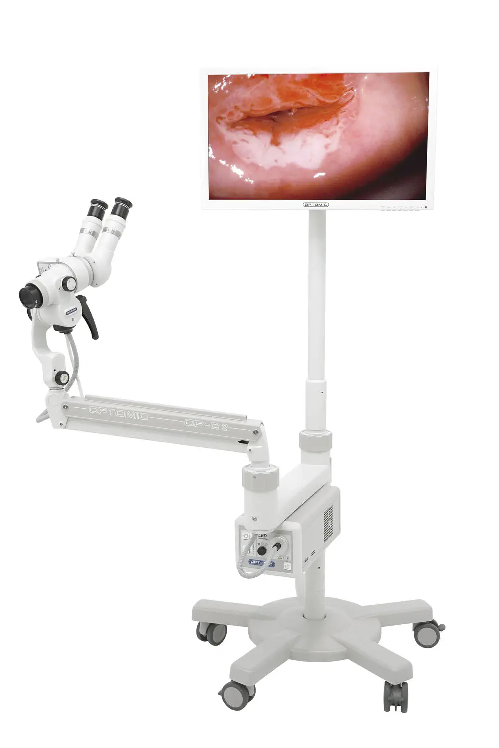 Colposcope OPTOMIC OP-C2