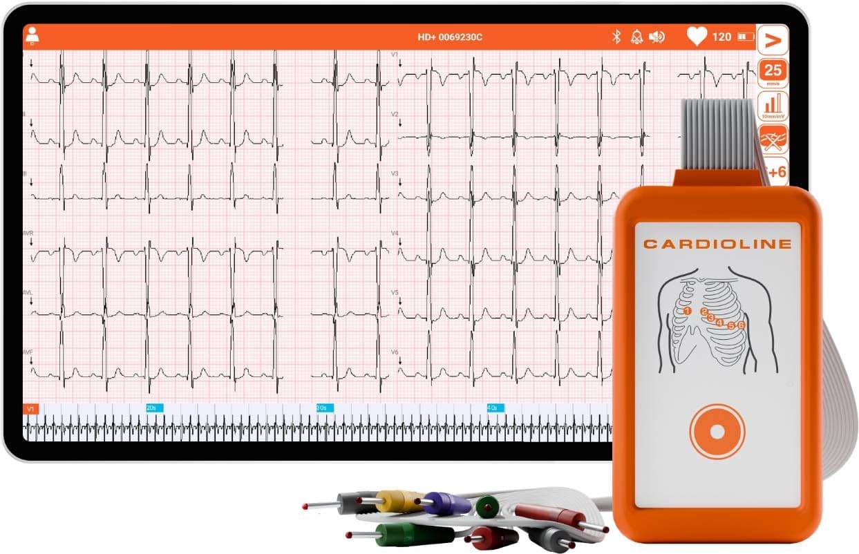 Electrocardiographe ECG Cardioline Touchecg HD+ Bluetooth (12 pistes)