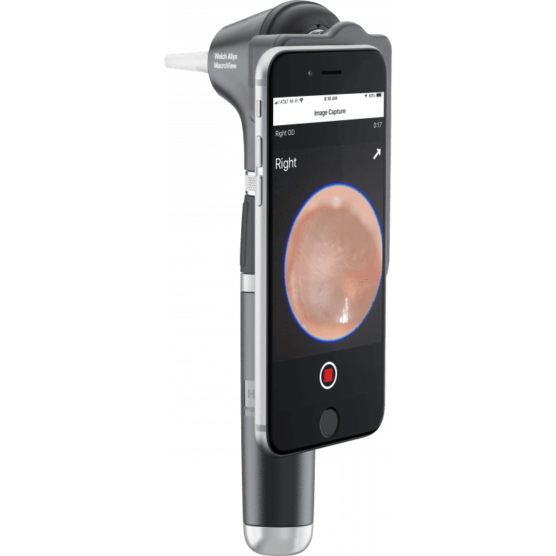 Welch Allyn MacroView 2 - Set otoscope LED