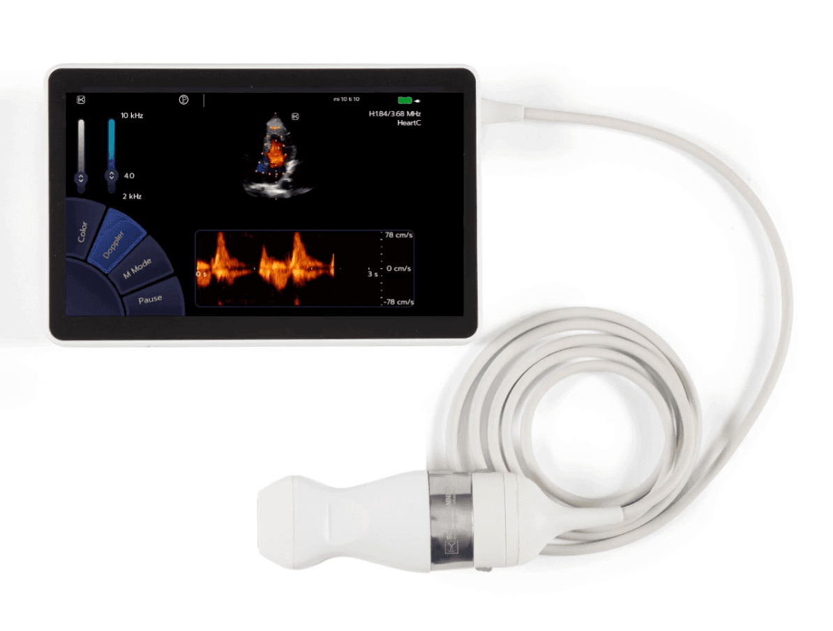 Sonoscanner U-Lite pro