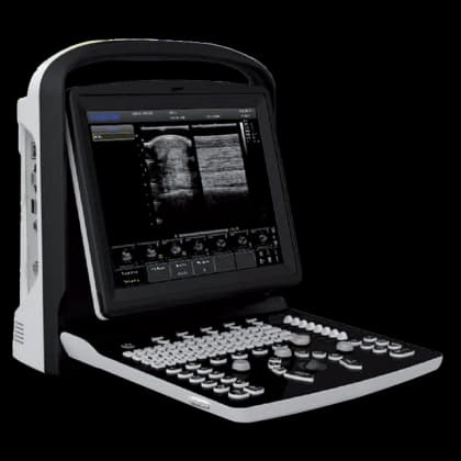 Echographe portable Chison ECO3