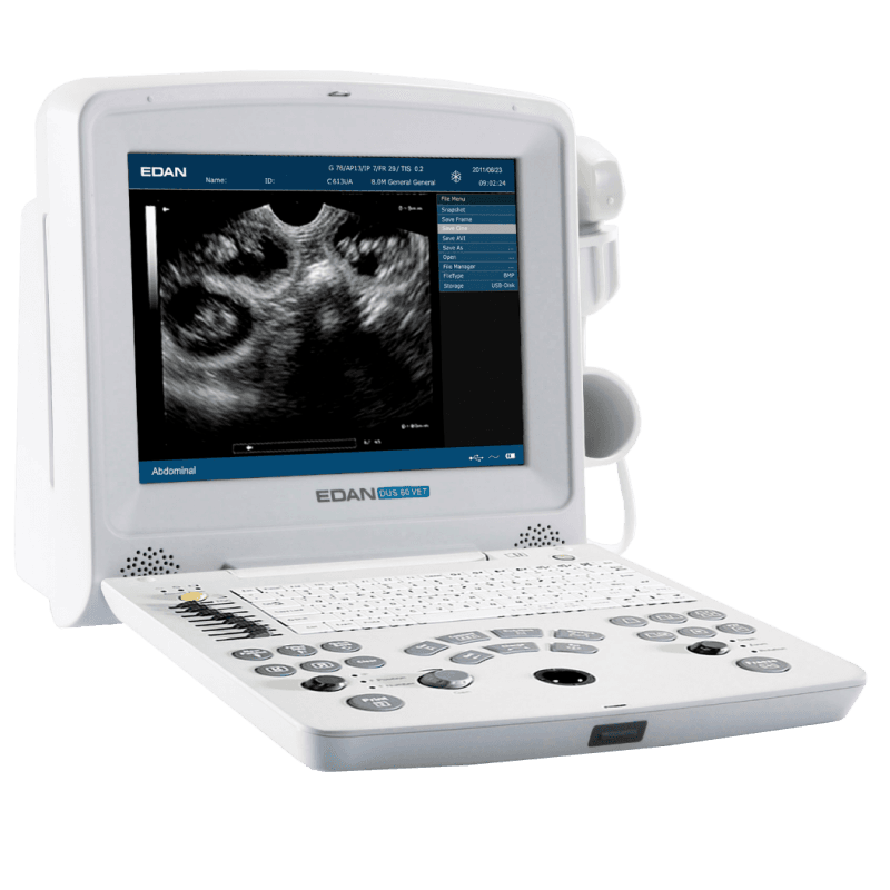 Échographe portable Edan DUS60-VET
